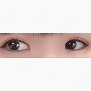 みやざき美容クリニック口コミ