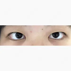 東京美容外科 銀座院口コミ