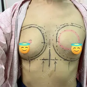 渋谷の森クリニック口コミ