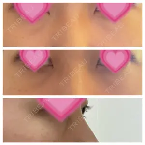 エートップ美容整形外科口コミ