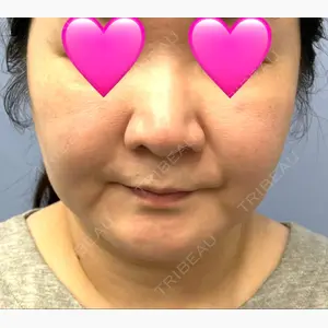 湘南美容クリニック 秋葉原院口コミ