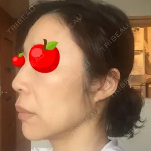 ミナ美容外科口コミ