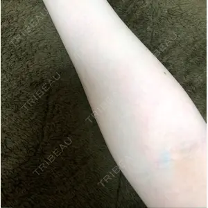 東京美容外科 大宮院口コミ