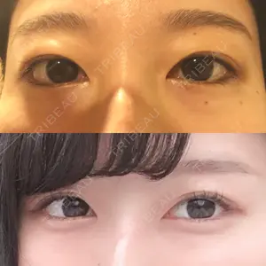 MIYAフェイスクリニック口コミ