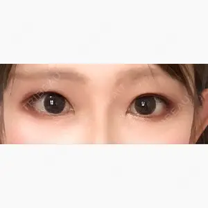 東京イセアクリニック口コミ