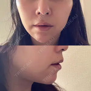 湘南美容クリニック 秋葉原院口コミ