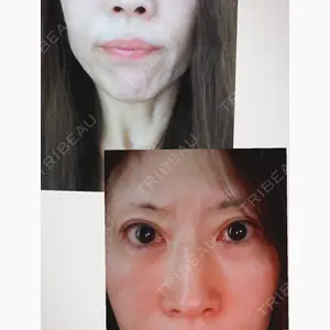 品川スキンクリニック広島院口コミ