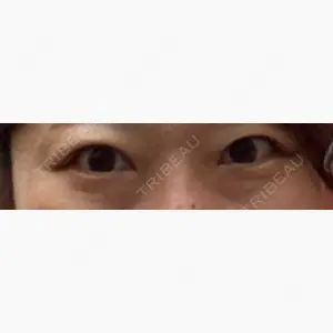 品川スキンクリニック立川院口コミ