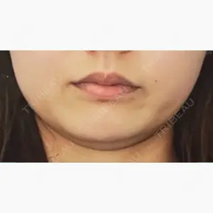 大塚美容形成外科 金沢院口コミ