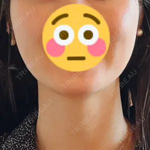 TCB スキンクリニック 大阪駅前院口コミ