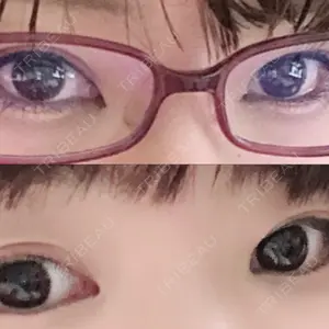 秋葉原美容クリニック口コミ