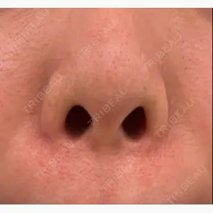 エースクリニック 大阪梅田HEPナビオ院口コミ