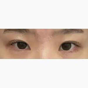 プロミス整形外科口コミ