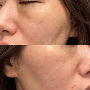 BISIN GINZA CLINIC口コミ