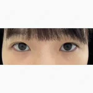 ツツイ美容外科口コミ