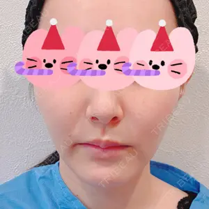 東京美専クリニック口コミ