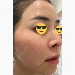 湘南美容クリニック 高崎院口コミ