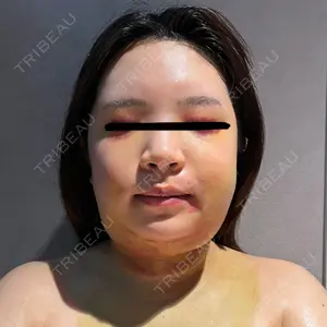 WOM SALON【術後ケア取扱いサロン】口コミ