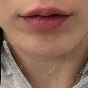 プムクリニック明洞店口コミ
