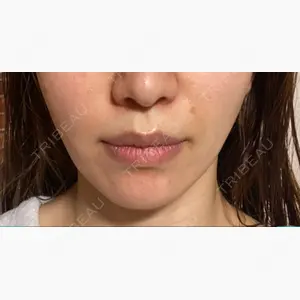 Rosa Beauty Clinic口コミ