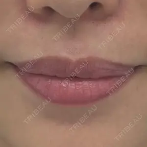 フィロクリニック口コミ