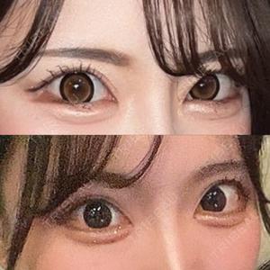 AND美容外科 名古屋院【アンド美容外科】口コミ