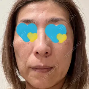 Floraエイジングケアクリニック口コミ