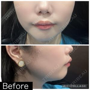 湘南美容クリニック 本厚木院口コミ