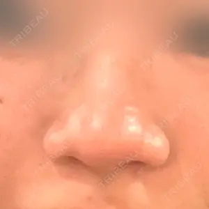 マイン美容外科口コミ