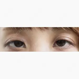 蘇春堂形成外科口コミ