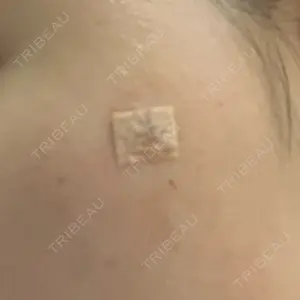 リッツ美容外科 大阪院口コミ