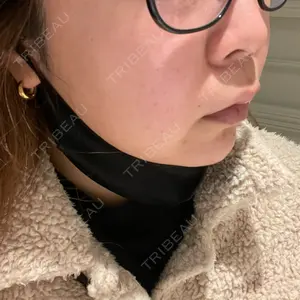 HAAB×DREAM BEAUTY CLINIC 東京本院口コミ