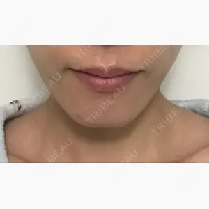 MIL CLINIC OSAKA口コミ
