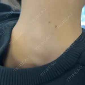 リッツ美容外科 大阪院口コミ