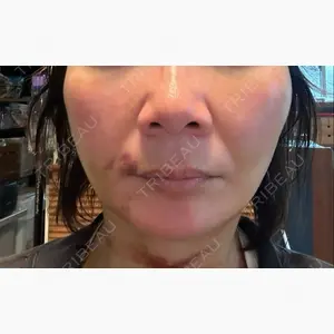 HAAB×DREAM BEAUTY CLINIC 東京本院口コミ