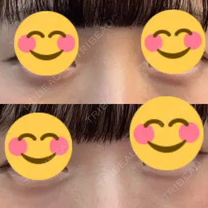 銀座みゆき通り美容外科 大阪梅田院口コミ