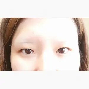 共立美容外科 高松院口コミ