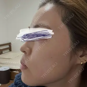X CLINIC 恵比寿院口コミ