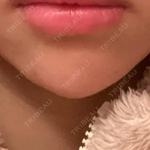 湘南美容クリニック 金山院口コミ