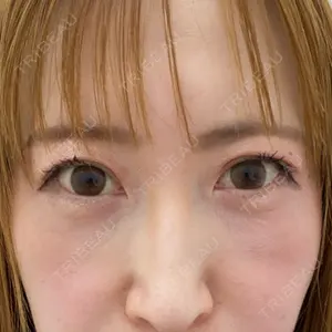 TCB東京中央美容外科 宇都宮院口コミ