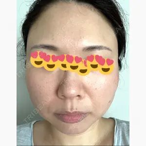 X CLINIC 大阪院口コミ