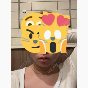 TCB東京中央美容外科 なんば院口コミ