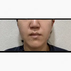 id（アイディ）美容外科口コミ