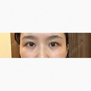スキンリファインクリニック銀座口コミ