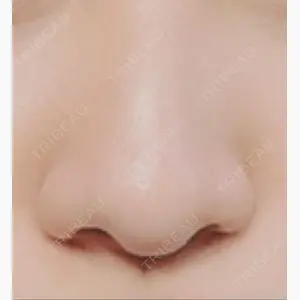 加美（GAMI）整形外科口コミ