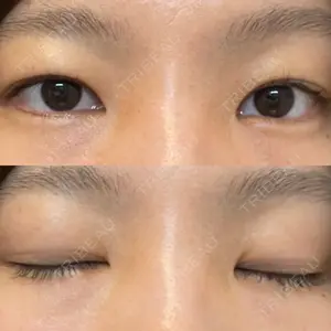 モティーフ銀座クリニック口コミ