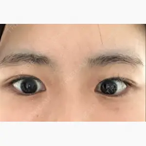 ツツイ美容外科口コミ