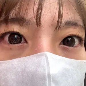BELINDA CLINIC（ベリンダクリニック）新宿院口コミ