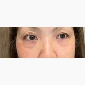 ヴェリテクリニック 銀座院口コミ