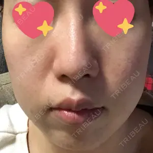 湘南美容クリニック 高松院口コミ